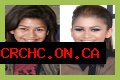 Unveiling The Secrets Of Zendaya's Nose Job: Discoveries And Insights